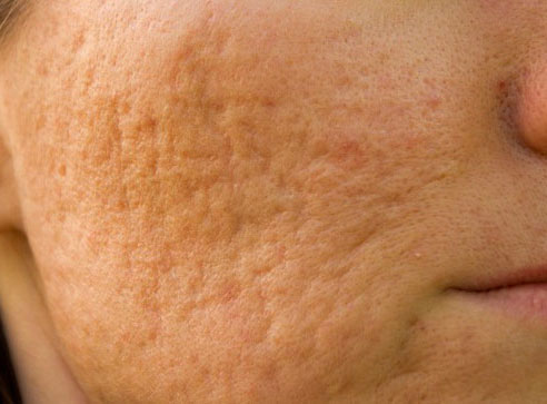 Dal quale i posti sulla faccia in 50 anni si sviluppano