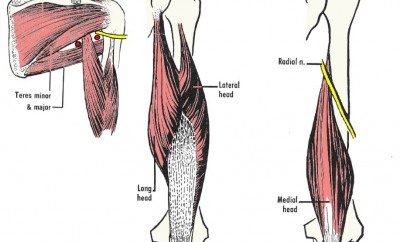 Strappo muscolare: definizione e rimedi